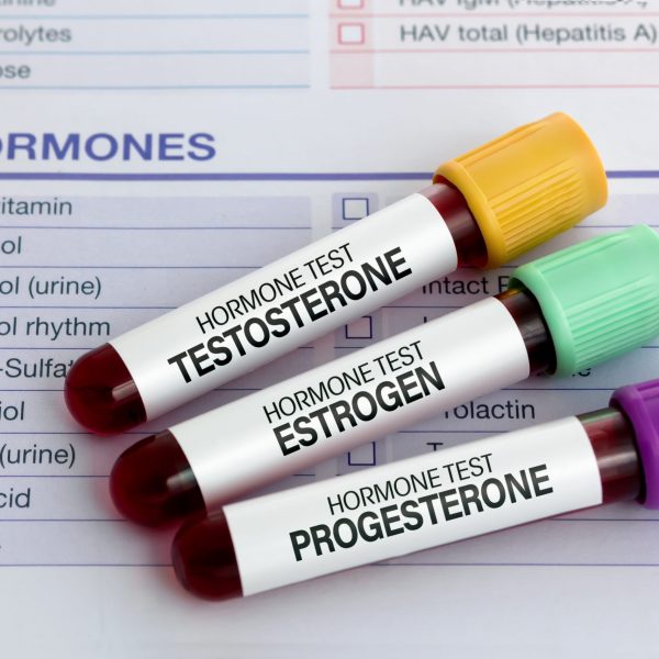 samples of Blood for sexual hormones Analysis Testosterone, Estrogen and Progesterone in men and women. Blood test tubes for Testosterone, Estrogen and Progesterone analysis hormonal
